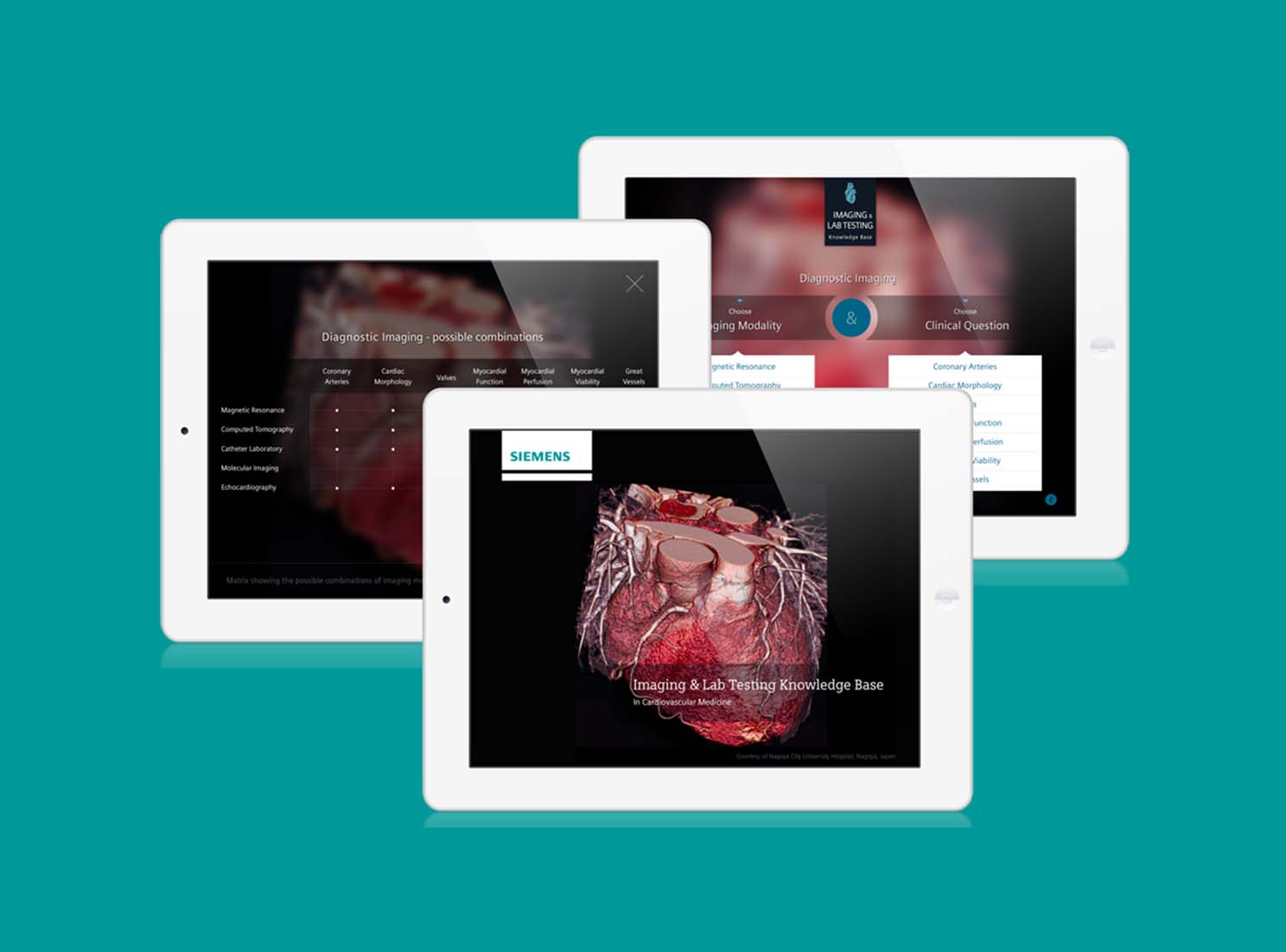 siemens cardiac ct software